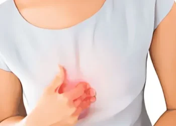 حرقة المعدة (أسبابها، كيفية الحد منها، طرق الوقاية)